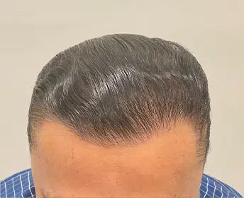 HAIR SPECIALIST